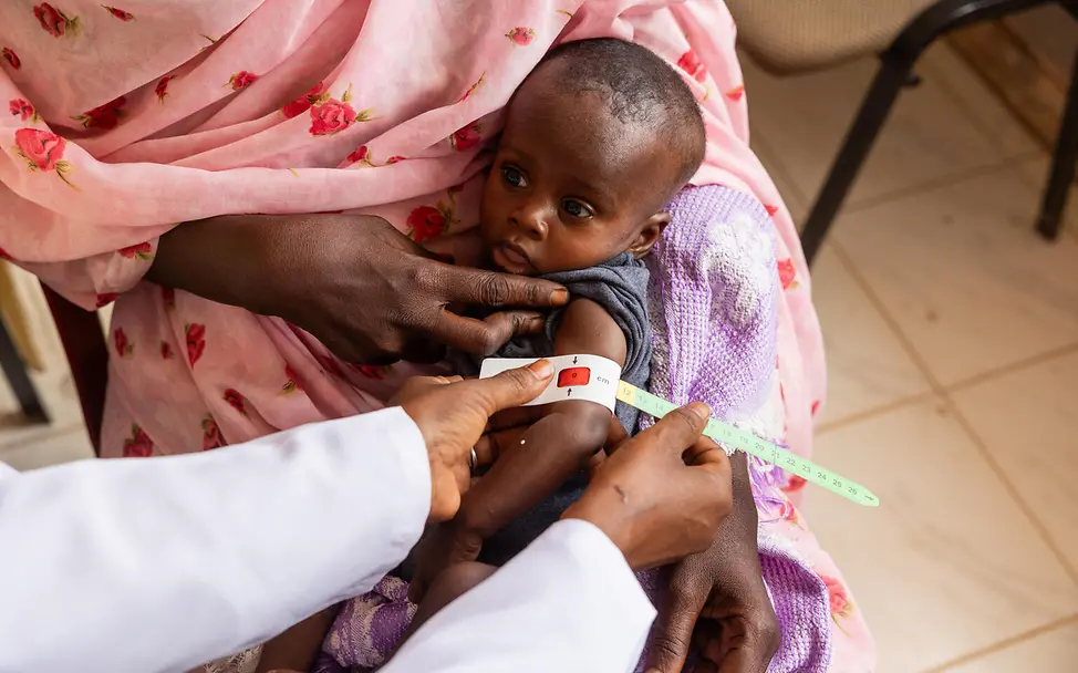 Untersuchung auf Mangelernährung im Sudan | © UNICEF/UNI880486/Elfatih Kind wird auf Mangelernährung untersucht